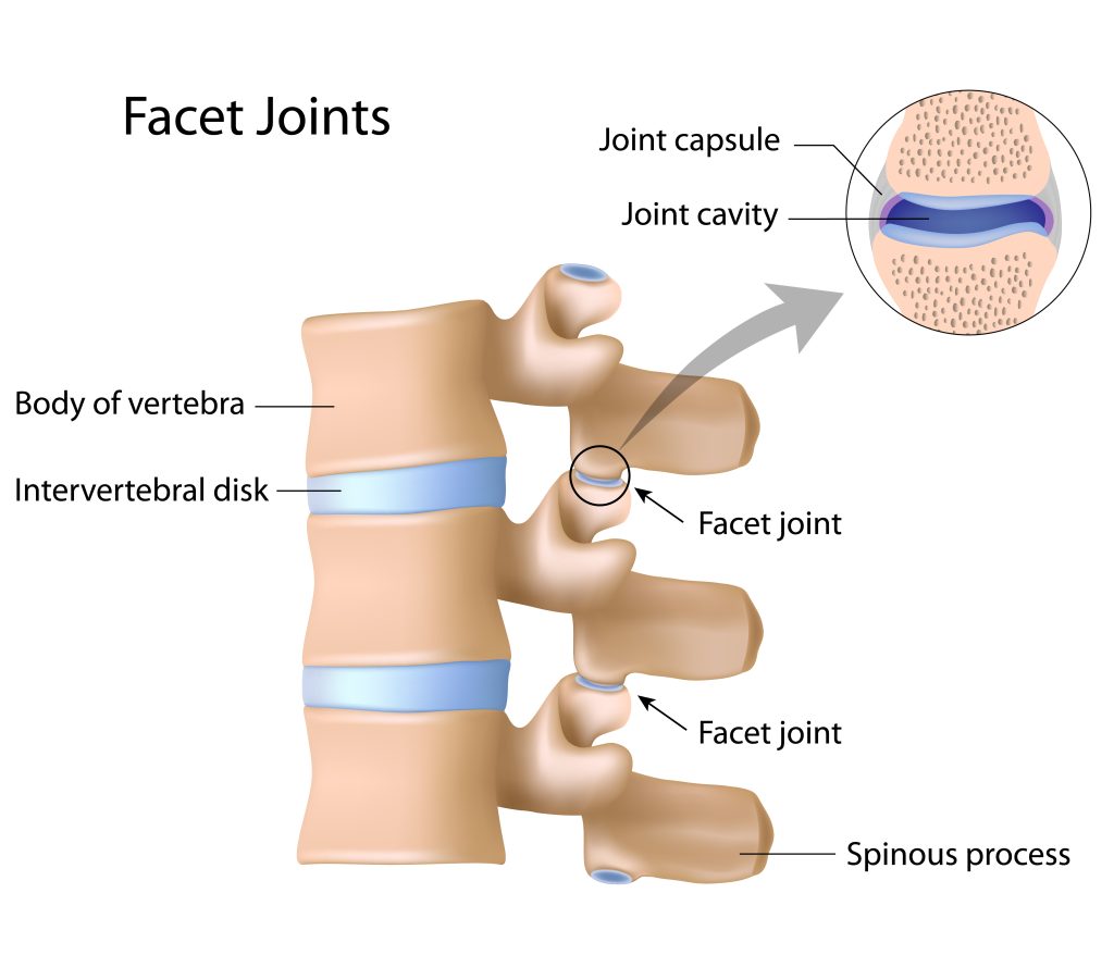 Facet Joint Intervention in Satellite, Ahmedabad